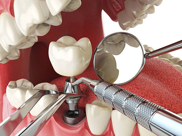 Best Same-Day Emergency Dental Services in Jnstown, OH